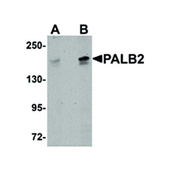 Anti-PALB2 (RABBIT) Antibody, 100µg, Liquid (sterile filtered)