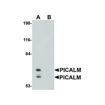 Anti-PICALM (RABBIT) Antibody, 100µg, Liquid (sterile filtered)