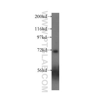 ACCN4 Rabbit Polyclonal Antibody (12003-1-AP)