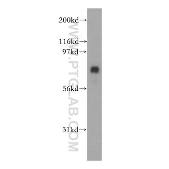 COG8 Rabbit Polyclonal Antibody (12661-1-AP)