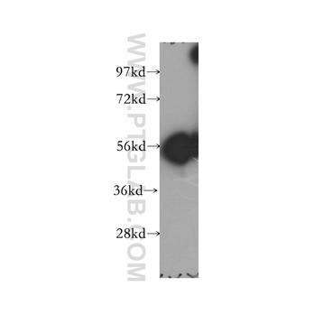 GLYCTK Rabbit Polyclonal Antibody (12426-1-AP)
