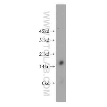 CRABP1 Rabbit Polyclonal Antibody (12588-1-AP)