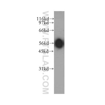 ACVR1C Rabbit Polyclonal Antibody (12610-1-AP)