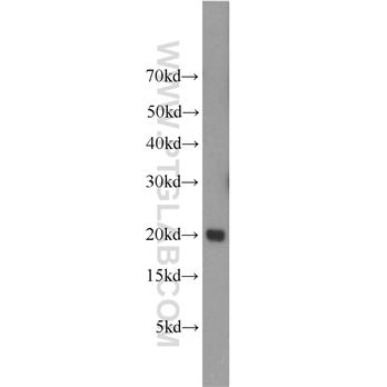 UBE2V1 Rabbit Polyclonal Antibody (10207-2-AP)