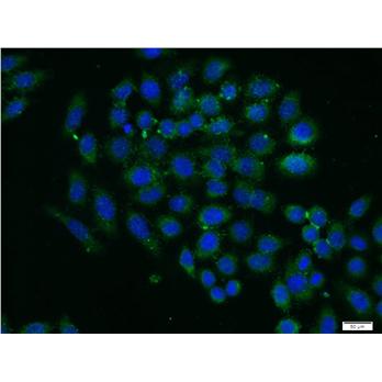 PXN Rabbit Polyclonal Antibody (10029-1-Ig)