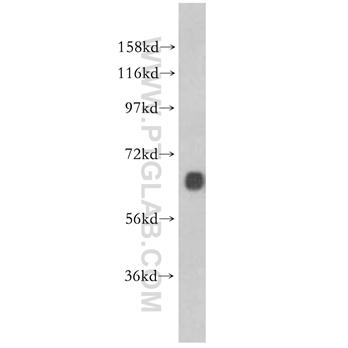 Marcksl1 Rabbit Polyclonal Antibody (10002-2-AP)