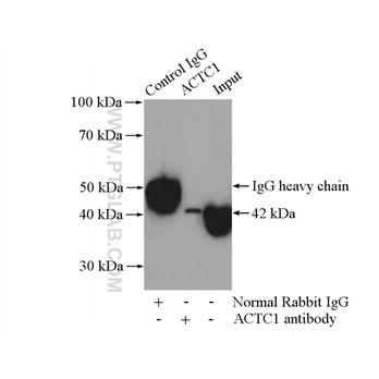 ACTC1 Rabbit Polyclonal Antibody (11032-1-AP)