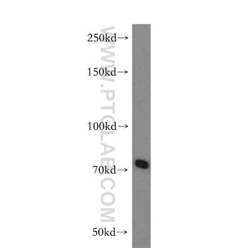 ABCB9 Rabbit Polyclonal Antibody (11066-1-AP)
