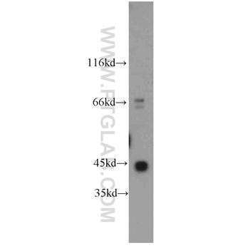 ACTG1 Rabbit Polyclonal Antibody (11227-1-AP)