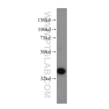 AASDHPPT Rabbit Polyclonal Antibody (11244-1-AP)