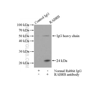 RAB8B Rabbit Polyclonal Antibody (11792-1-AP)