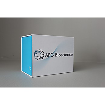 Human Deoxyribonuclease gamma(DNASE1L3) Elisa Kit