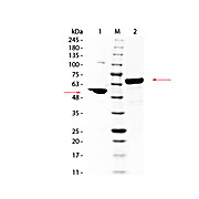 HUMAN ALBUMIN, 5mg