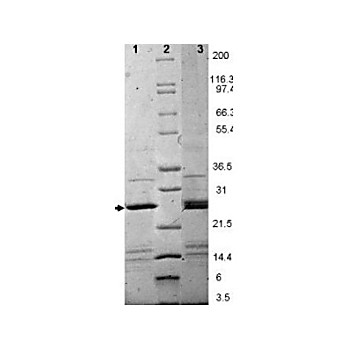 EBI-3 Human Recombinant Protein, 20µg