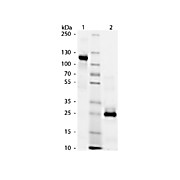 HUMAN IgG F(ab')2 fragment, 2mg