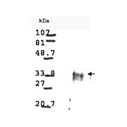 Anti-Cyclin D1 (RABBIT) Antibody, 100µL, Liquid (sterile filtered)