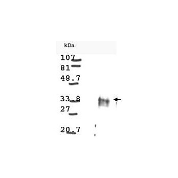 Anti-Cyclin D1 (RABBIT) Antibody, 100µL, Liquid (sterile filtered)