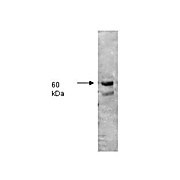 Anti-ALKALINE PHOSPHATASE (Human Intestine) (RABBIT) Antibody, 2mL, Lyophilized