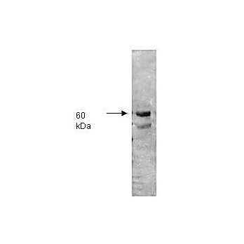 Anti-ALKALINE PHOSPHATASE (Human Intestine) (RABBIT) Antibody, 2mL, Lyophilized