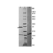 IL-17A Mouse Recombinant Protein, 25µg
