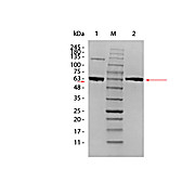 AKT1 Human Recombinant Protein, 10µg