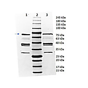 OspA Control Protein, 100µg