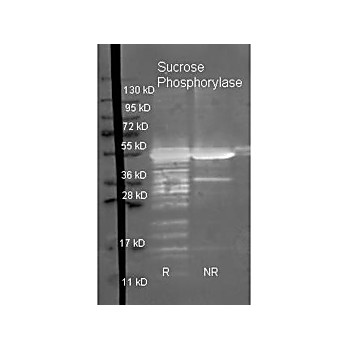 Anti-SUCROSE PHOSPHORYLASE (E.coli) (GOAT) Antibody, 2mL, Lyophilized