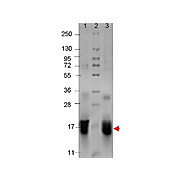 IL-4 Human Recombinant Protein, 20µg