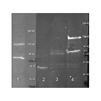 Anti-ADENOSINE DEAMINASE (Calf Spleen), 2mL, Lyophilized