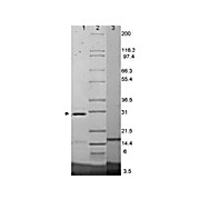 IL-17F Mouse Recombinant Protein, 25µg