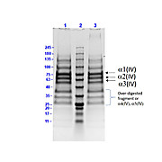 Human COLLAGEN Type IV, 500µg