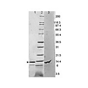 Leptin Human Recombinant Protein, 1000µg