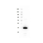 Recombinant Red Fluorescent Protein (RFP) Control, 100µg