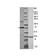 VEGF-121 Human Recombinant Protein, 10µg