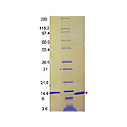 MCP-1 Human Recombinant Protein, 20µg