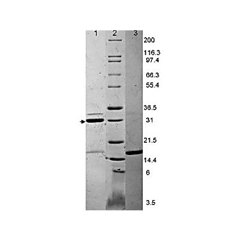 IL-17A Human Recombinant Protein, 25µg