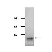 Anti-ALDOLASE [Rabbit Muscle] (GOAT) Antibody, 2mL, Lyophilized