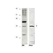 Hus1B Peptide, 50µg
