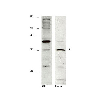 Hus1B Peptide, 50µg