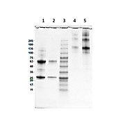 HUMAN IgA whole molecule, 1mg