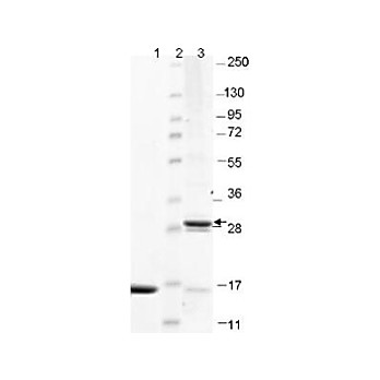IL-17F Human Recombinant Protein, 25µg