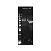 Anti-PLASMINOGEN (Human Plasma) (GOAT) Antibody, 2mL, Lyophilized