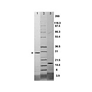 IL-17F Rat Recombinant Protein, 25µg