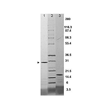 IL-17F Rat Recombinant Protein, 25µg