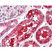 Anti-FERRITIN (Human Spleen) (RABBIT) Antibody, 2mL, Lyophilized