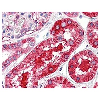 Anti-FERRITIN (Human Spleen) (RABBIT) Antibody, 2mL, Lyophilized