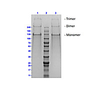 Human COLLAGEN Type II (ADULT KNEE CARTILAGE), 100µg