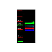 Anti-ALPHA-1-ANTI-TRYPSIN (Human Plasma) (GOAT) Antibody, 2mL, Lyophilized