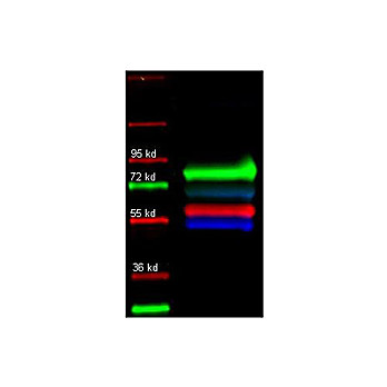 Anti-ALPHA-1-ANTI-TRYPSIN (Human Plasma) (GOAT) Antibody, 2mL, Lyophilized