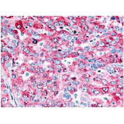 Anti-EGFR (RABBIT) Antibody, 250µL, Liquid (sterile filtered)